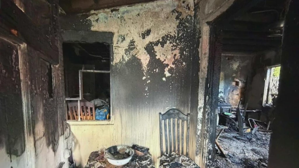 Woman hospitalized after Miami house fire leaves three displaced — CBS Miami, Wellington Health news