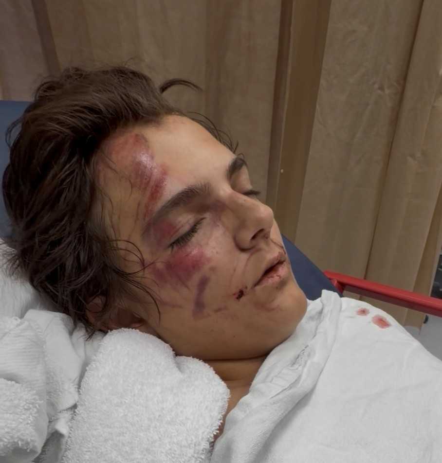 Father of boy hit by SUV in Boynton Beach urges drivers to be more careful — Wellington Community news